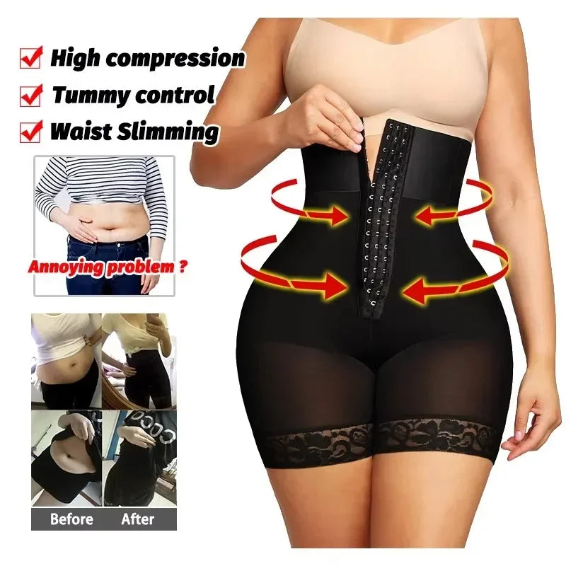 High-Waisted Mid-Thigh Shaping Shorts with Center Closure and Floral Lace Hem